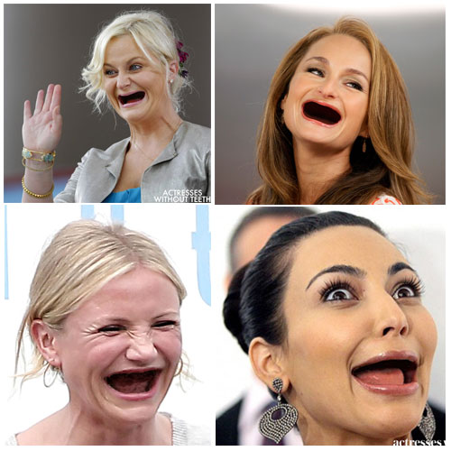 Actresses Without Teeth Meme Template