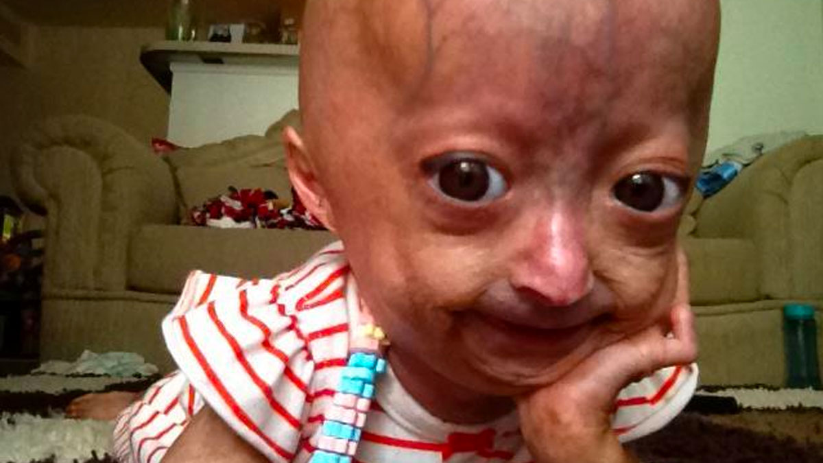 Adalia Rose