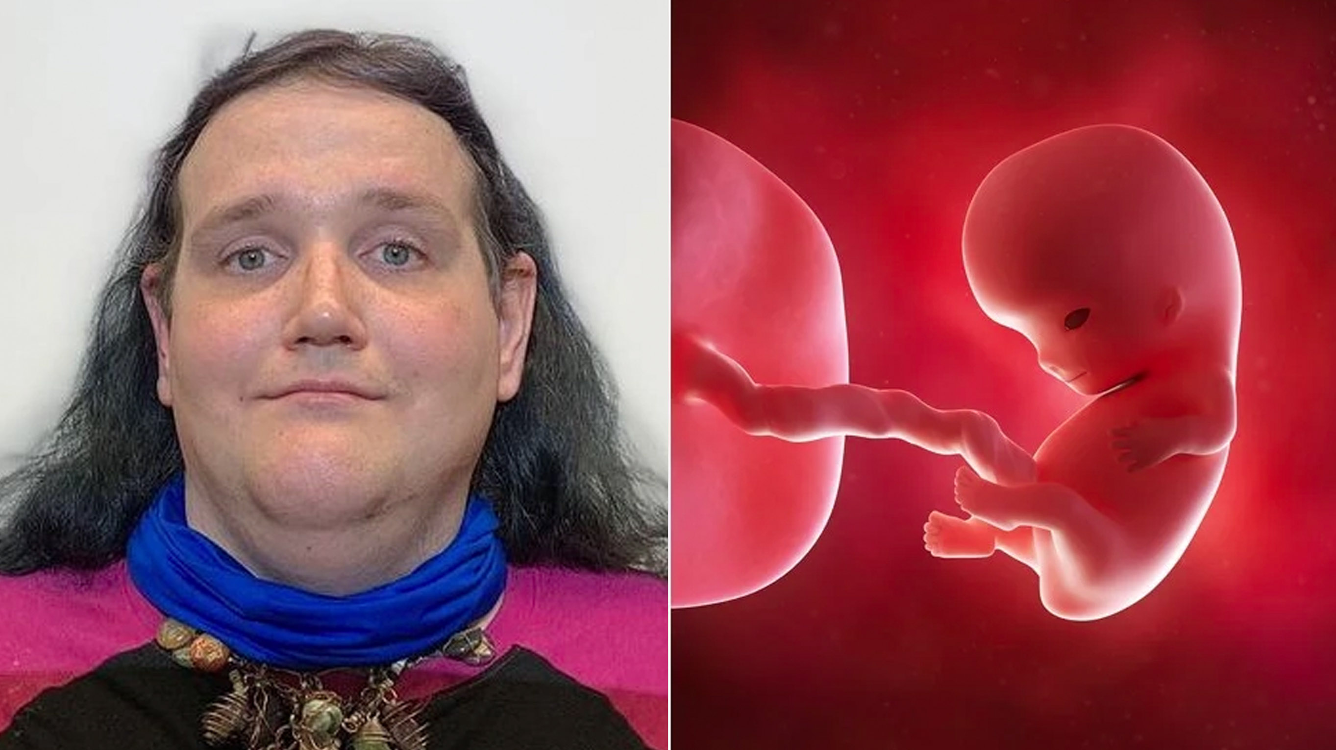 Chris-Chan Child Rumor