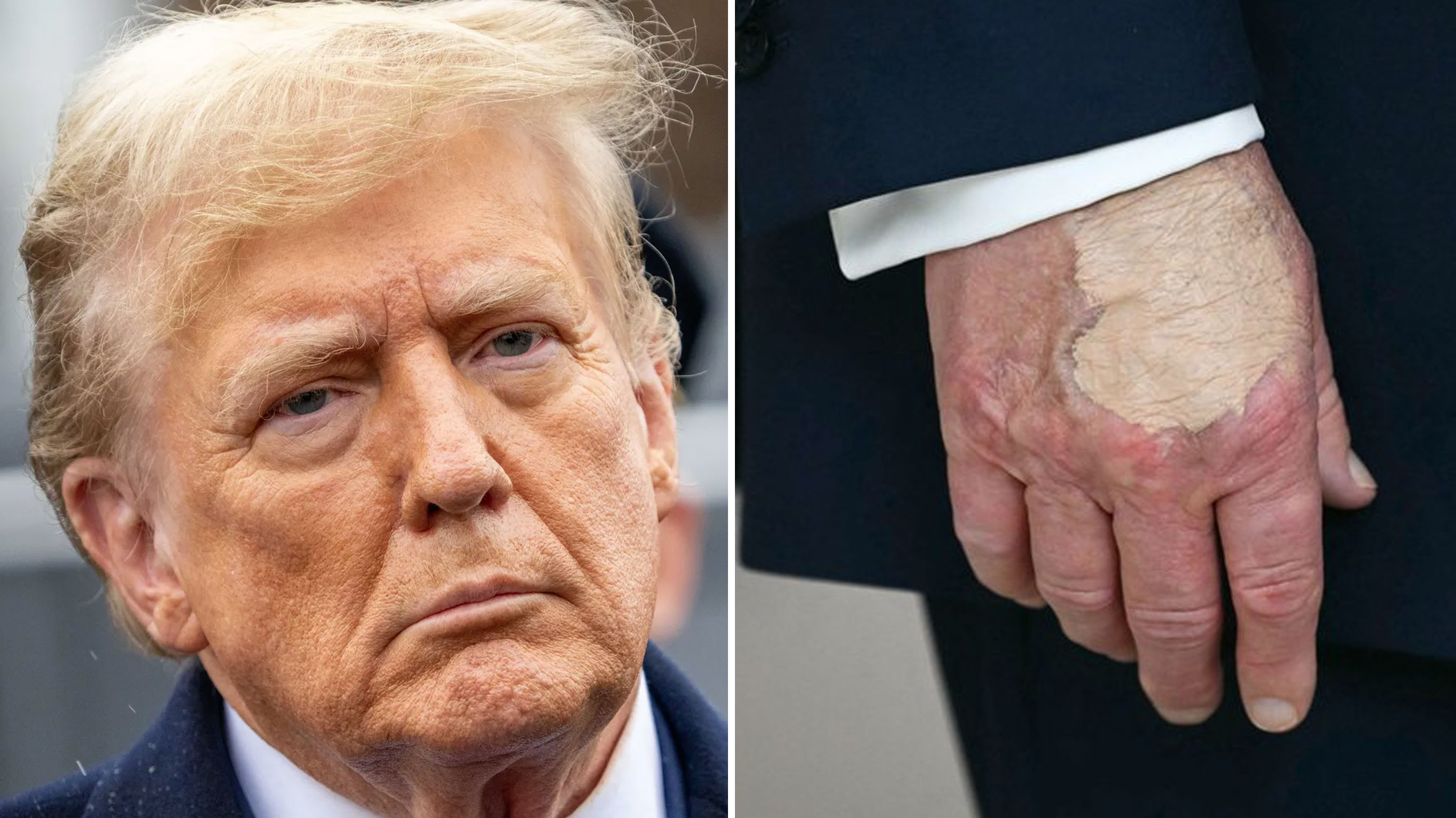 Donald Trump's Hand Makeup and Death Speculation