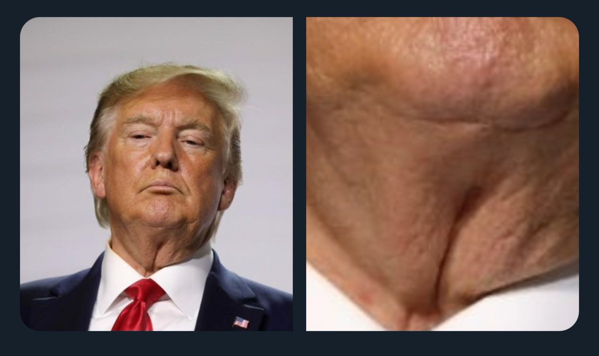Donald Trump's Neck Pussy