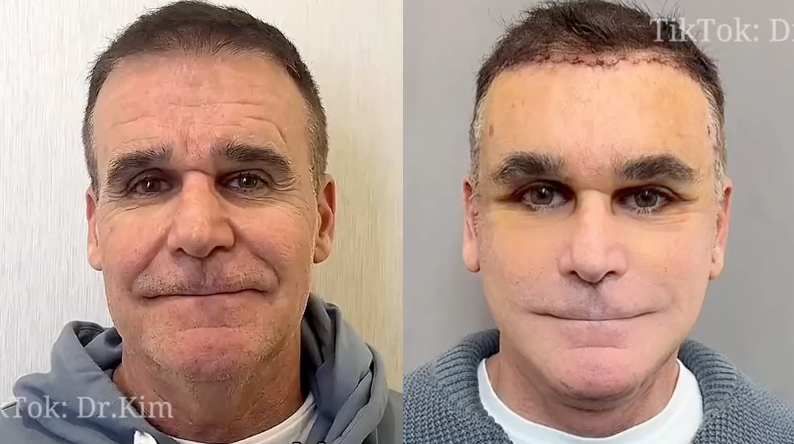 Dr. Kim Plastic Surgeon (TikTok)