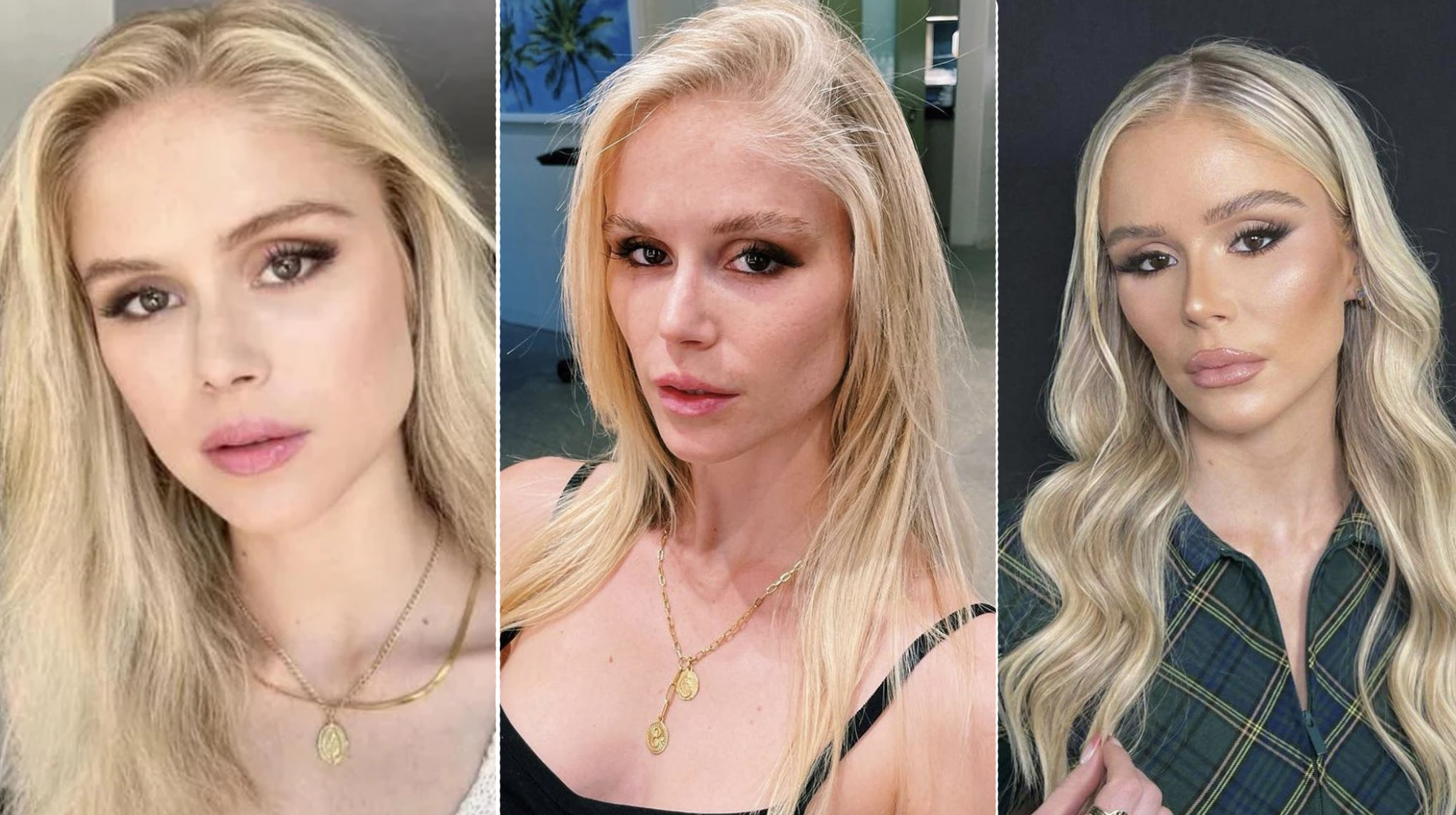 Erin Moriarty Plastic Surgery Meme Template