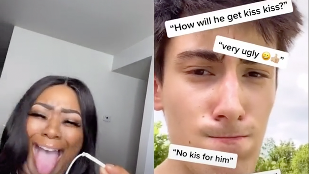 He Has No Lips! How Will He Get A Kiss Kiss?