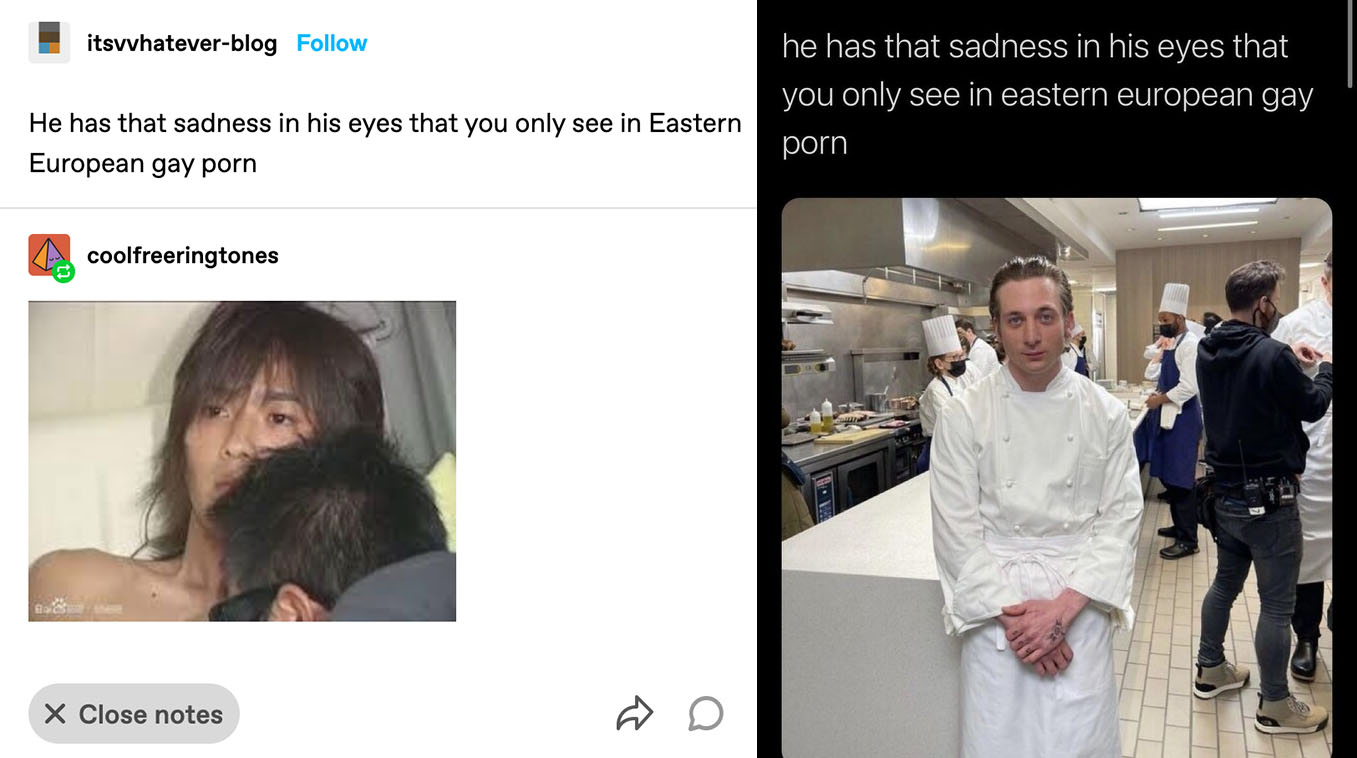 He Has That Sadness In His Eyes That You Only See In X