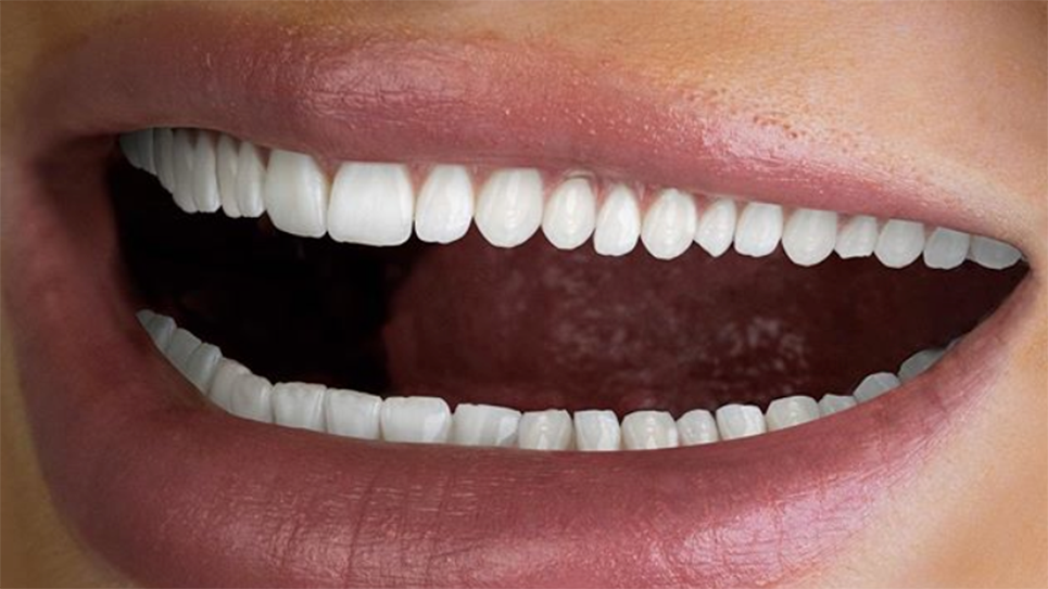 Hi Smile Tiny Teeth Advertisement