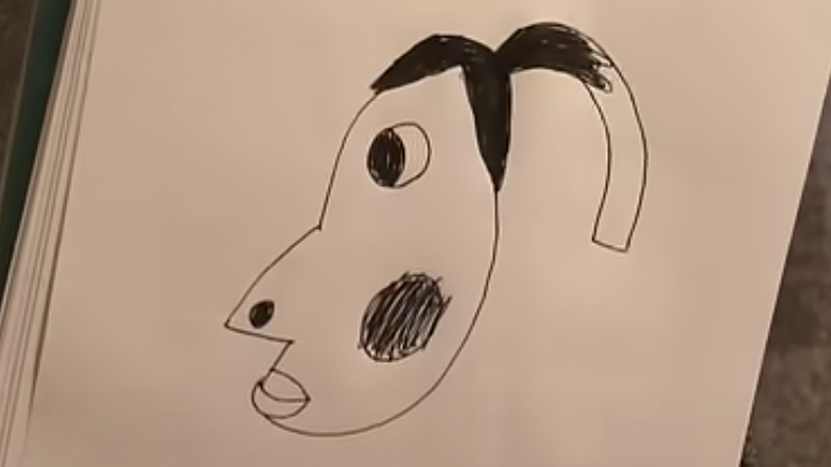 Is That Hyperpigmentation?