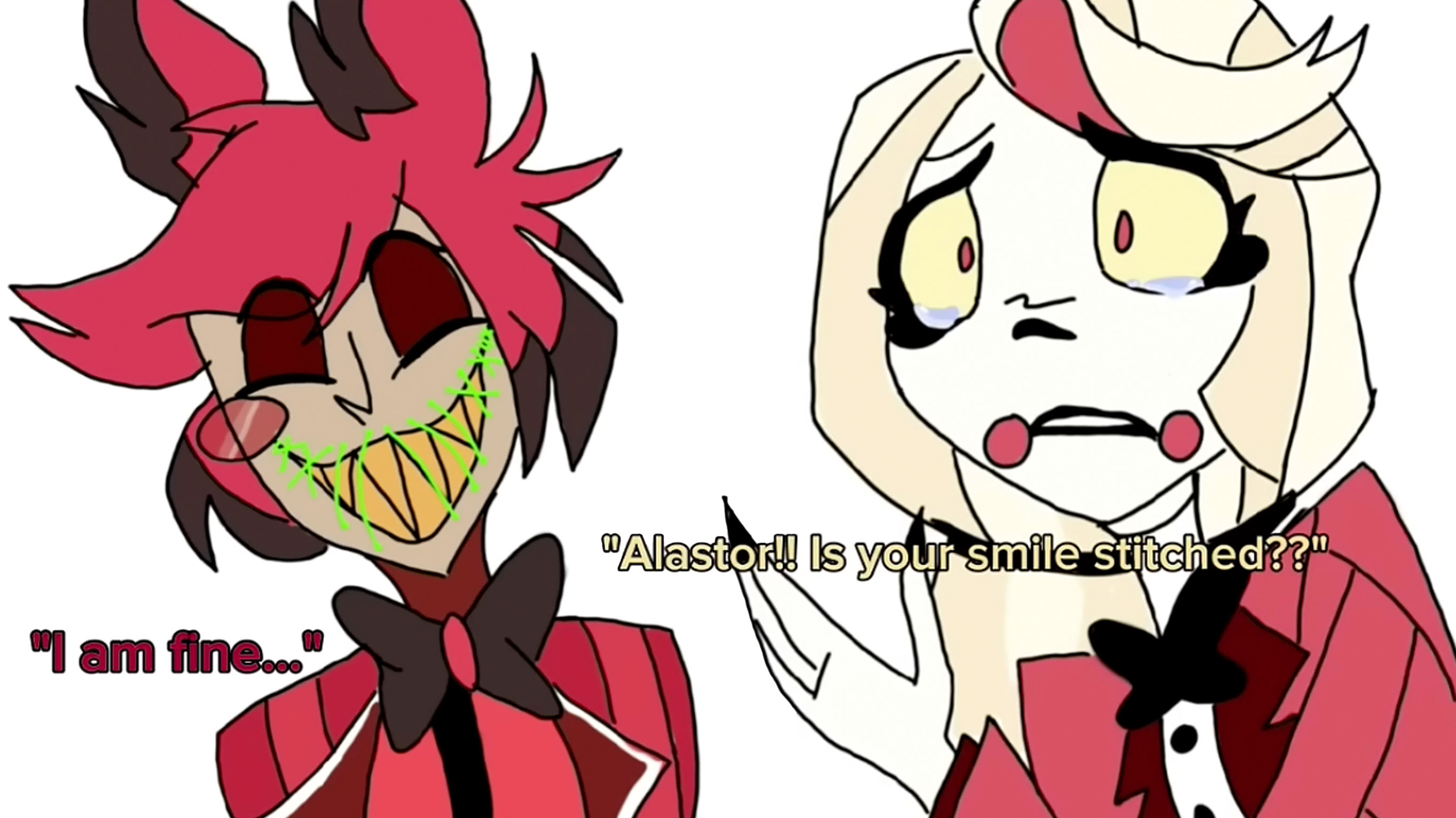 Is Your Smile Stitched?