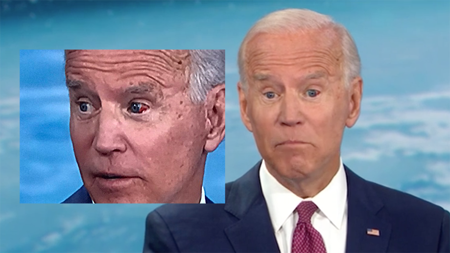 Joe Biden's Bleeding Eye Meme Template
