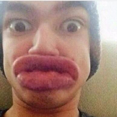 Kylie Jenner Lip Challenge