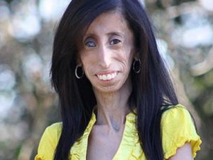 Lizzie Velasquez Meme Template