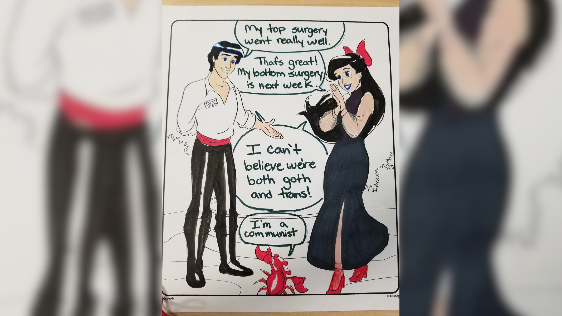 My Top Surgery Went Really Well