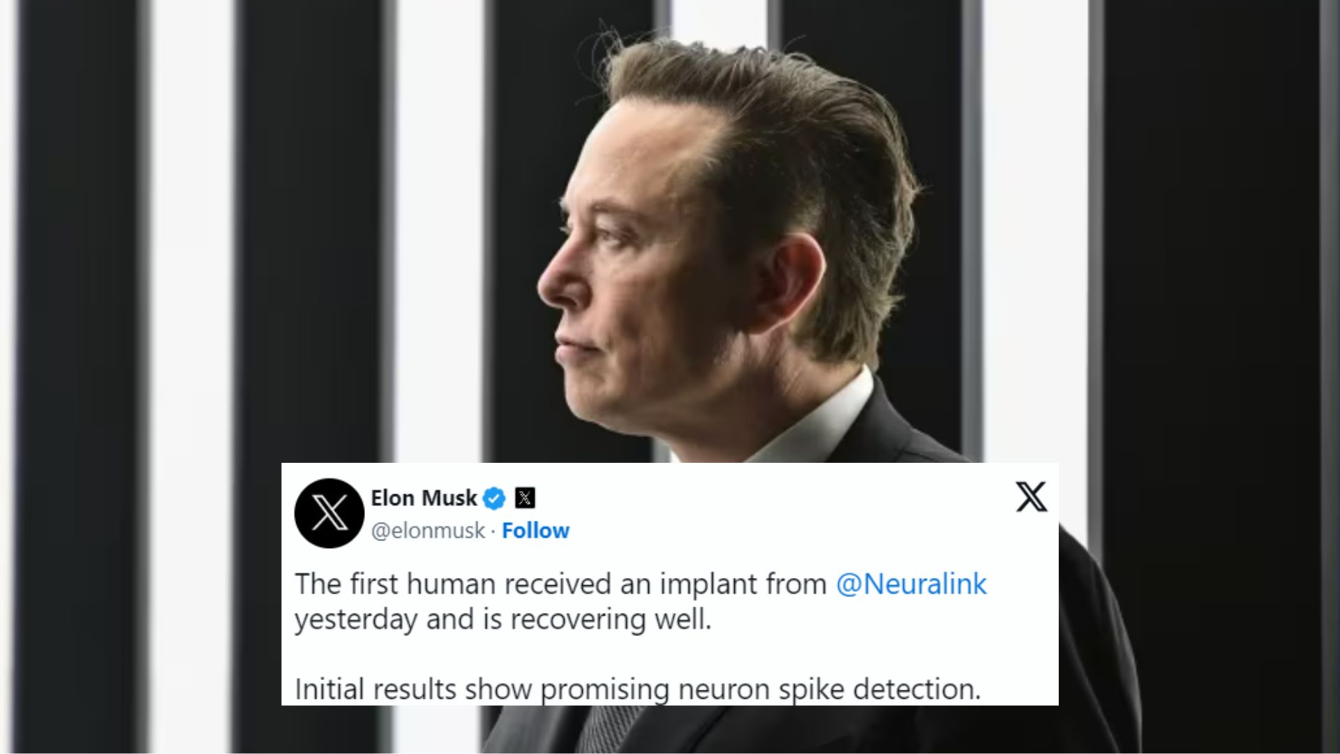 Neuralink Brain Chip Implant Meme Template