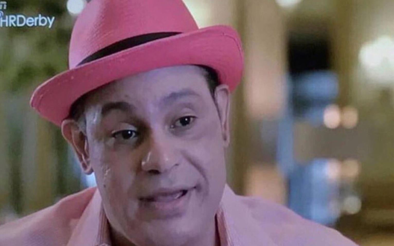 Sammy Sosa's Bleached Skin