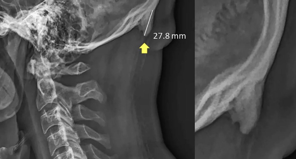 "Texting Horns" Theory