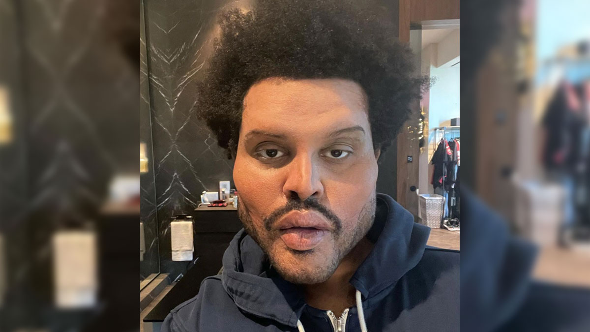 The Weeknd's Plastic Surgery Face