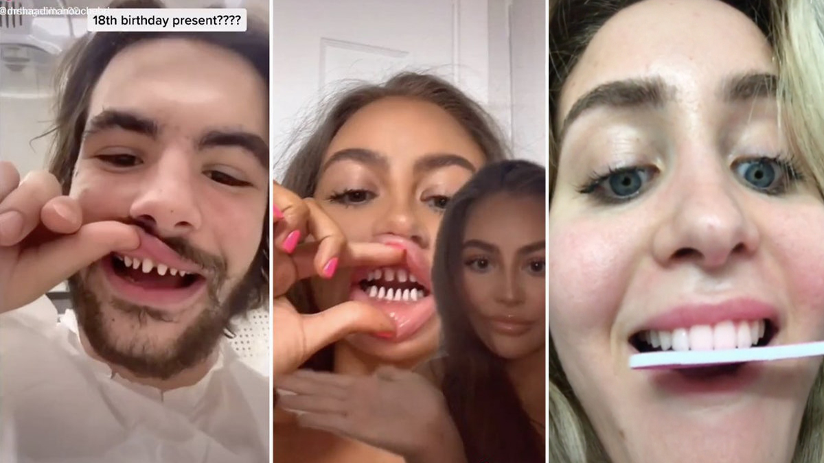 TikTok Teeth Shaving