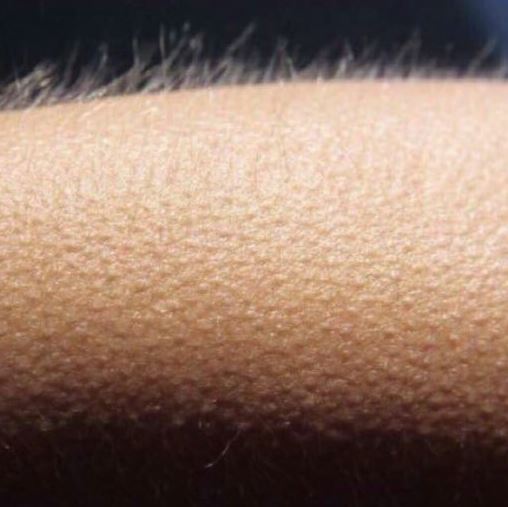 Whisper in Ear Goosebumps