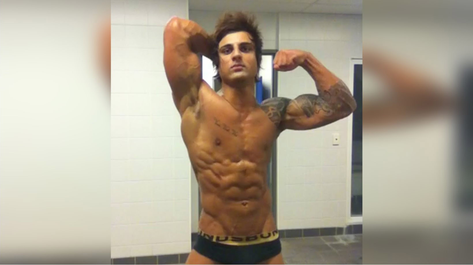 Zyzz